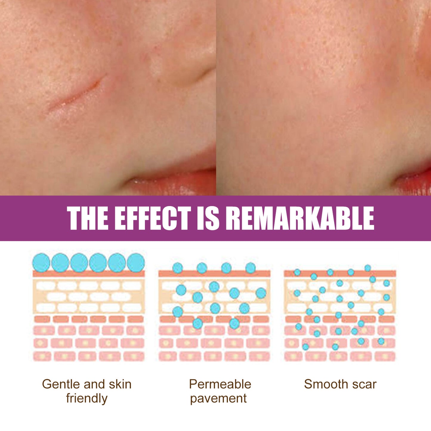 Fade Scars Skin Smoothing Cream