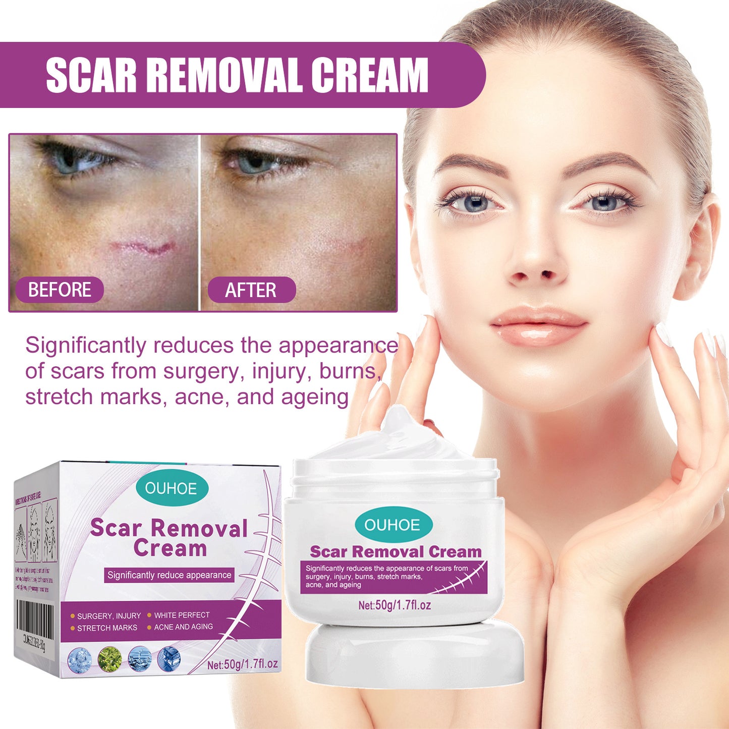 Fade Scars Skin Smoothing Cream
