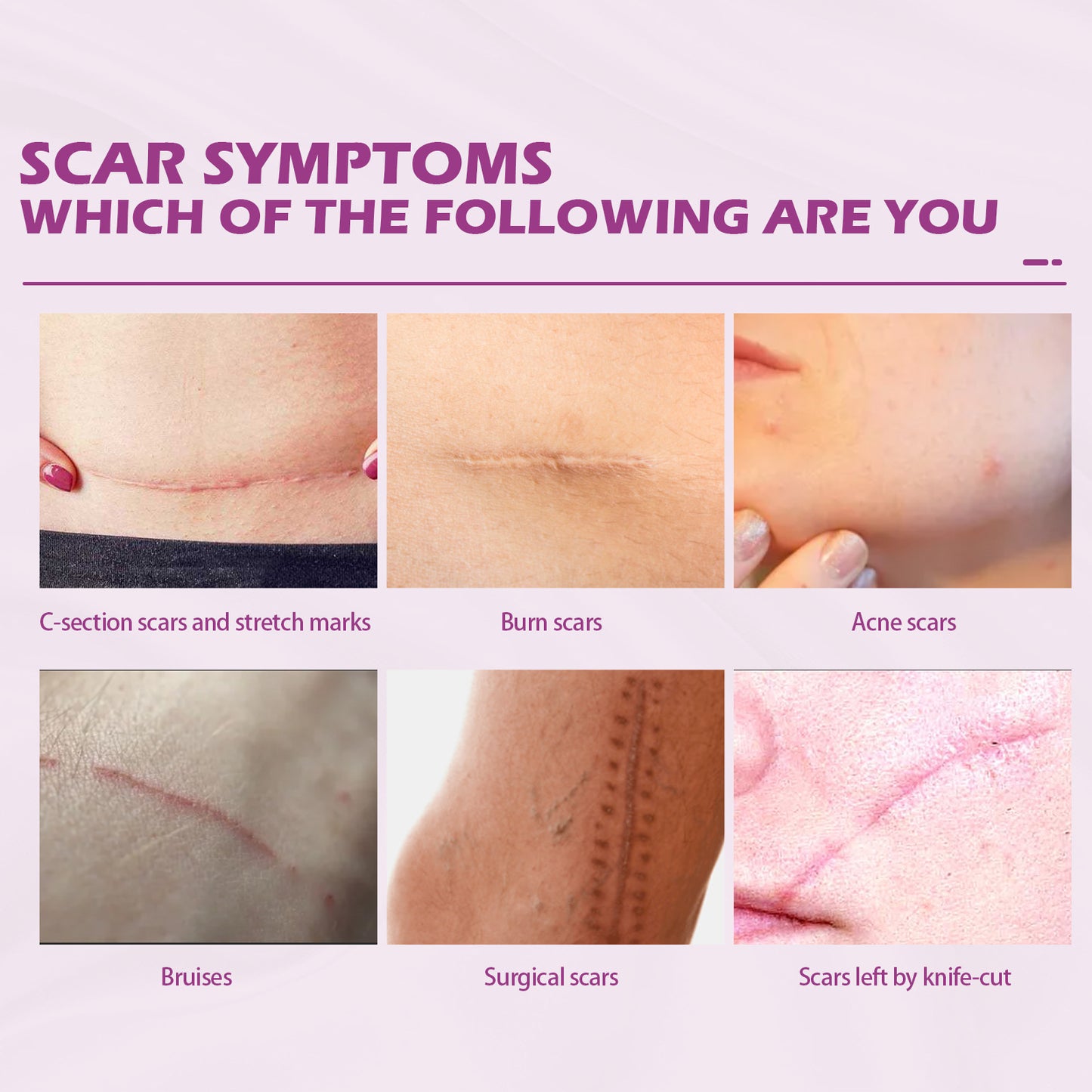 Fade Scars Skin Smoothing Cream
